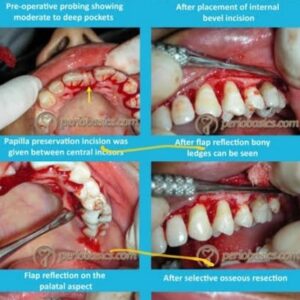 PERIODONTAL