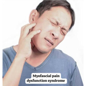 Myofascial-pain-dysfunction-syndrome