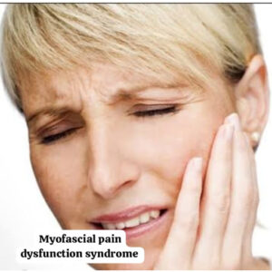 Myofascial-pain-dysfunction-syndrome_2